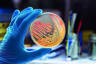 Hand im Gummihandschuh, die eine Petrischale mit Inhalt ins Bild hält